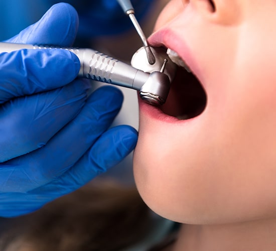  Chantilly Pediatric Dentistry  Dental Checkup